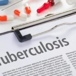 vaksin tuberkulosis (TBC)