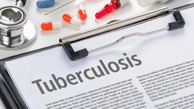 vaksin tuberkulosis (TBC)